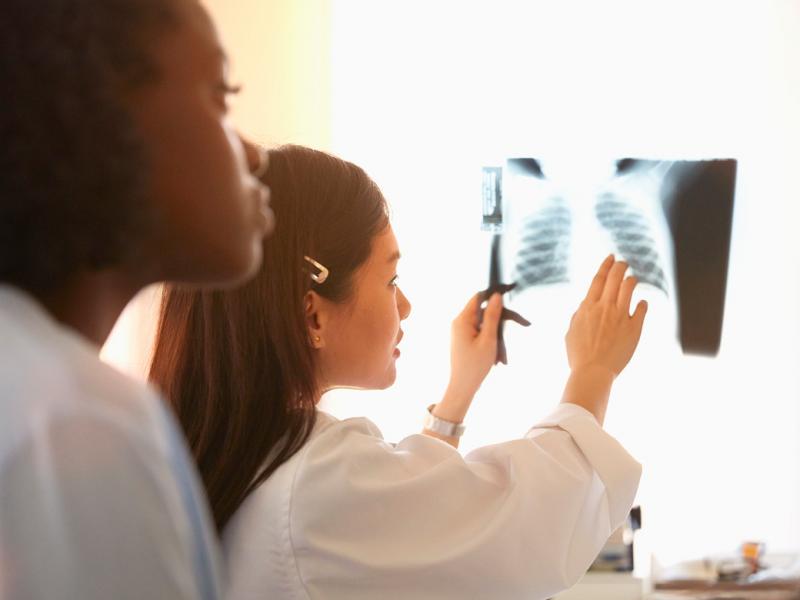 Two health care professionals looking at a chest x-ray.