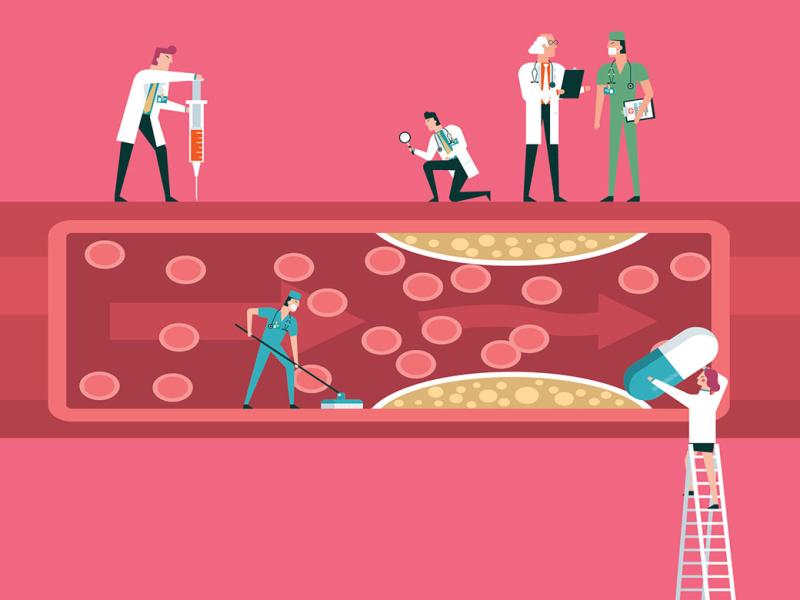 Illustration of team of physicians diagnosing human blood vessel