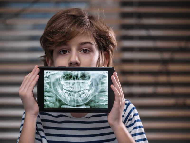 Child holding tablet with a picture of x-ray teeth