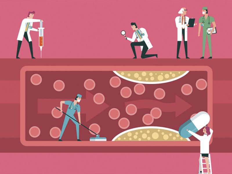 Team of doctors diagnose giant human blood vessel