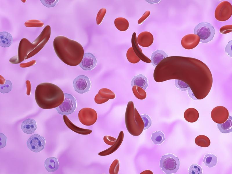 Red blood cells affected by sickle cell anaemia