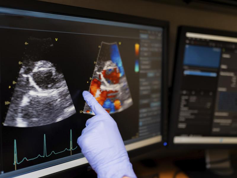Hand pointing to heart image on an ultrasound screen