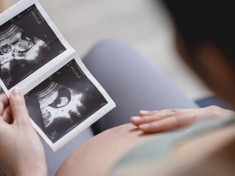 Pregnant patient holds an ultrasound photo