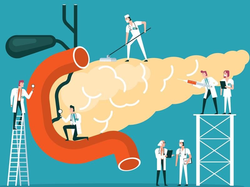 Doctors diagnose human pancreas