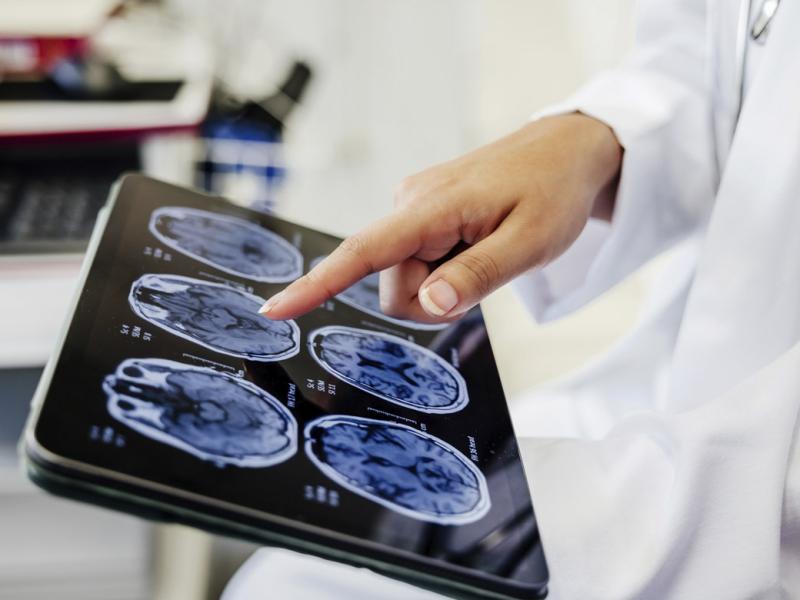  Doctor's hand pointing on brain scan images on digital tablet