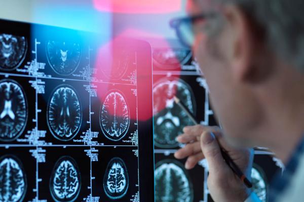 Physician reviewing multiple images of a brain scan