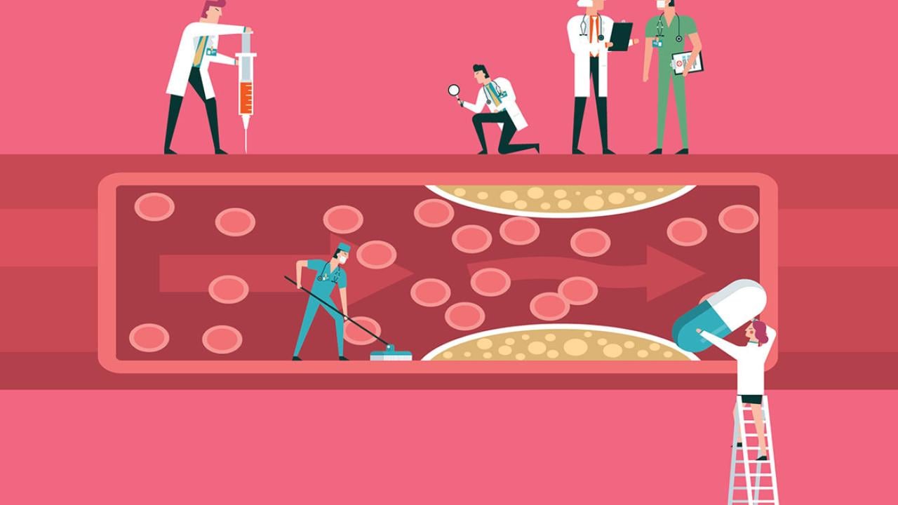 What doctors wish patients knew about high cholesterol | American ...