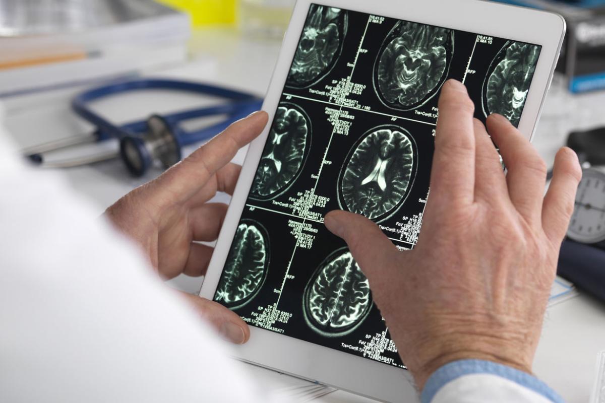 Physician reviewing brain scans on computer tablet