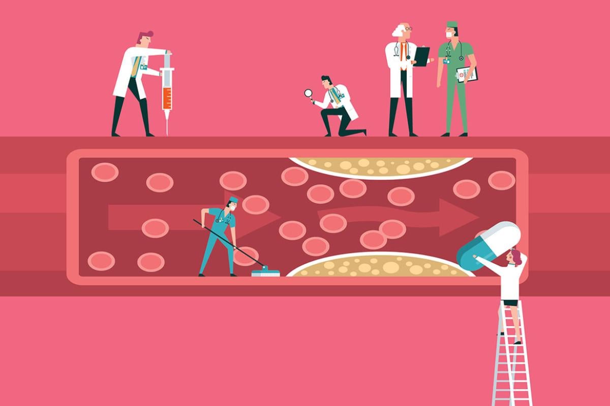 Illustration of team of physicians diagnosing human blood vessel
