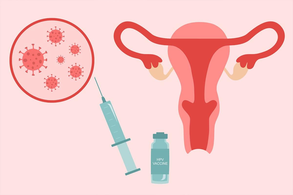 Uterus, HPV virus cells, syringe and vaccine vial