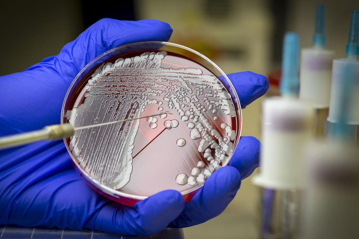 Colonies of the pathogenic MRSA bacteria on blood agar culture plate