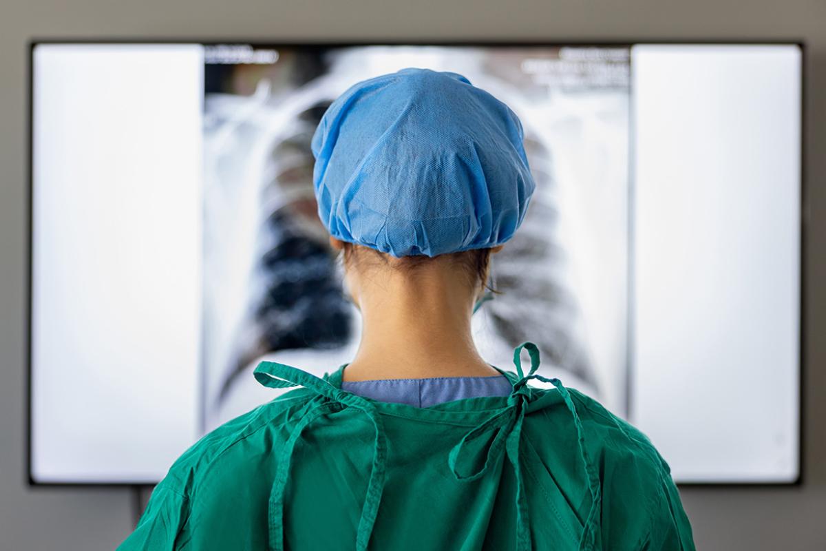 Medical student looking at an x-ray at the hospital
