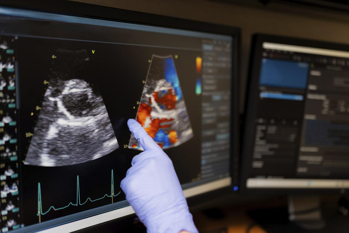 Hand pointing to heart image on an ultrasound screen