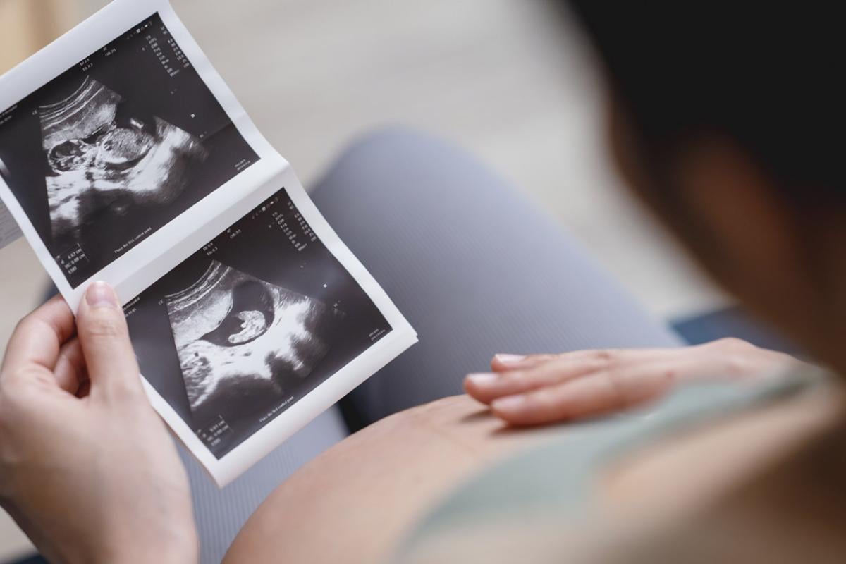 Pregnant patient holds an ultrasound photo