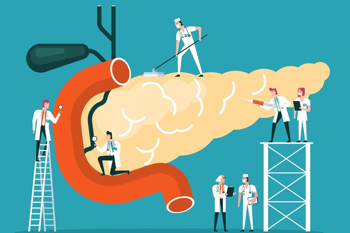 Doctors diagnose human pancreas