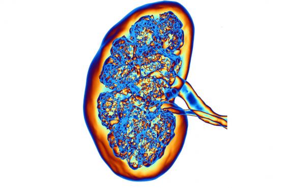 CT scan of a kidney