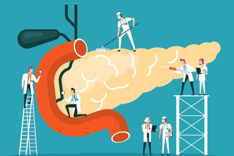 Doctors diagnose human pancreas